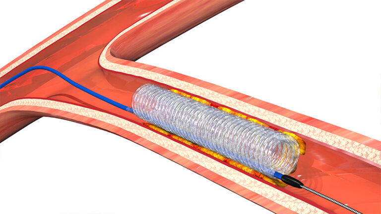 Image For Activity Cover